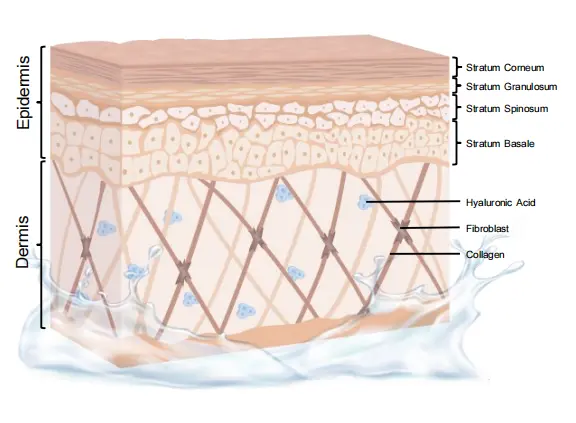 moistboom step moistboom step