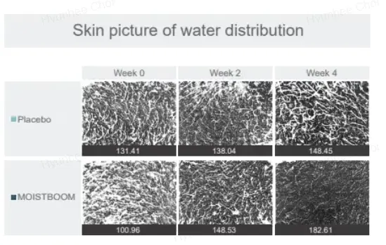 skin water distribution